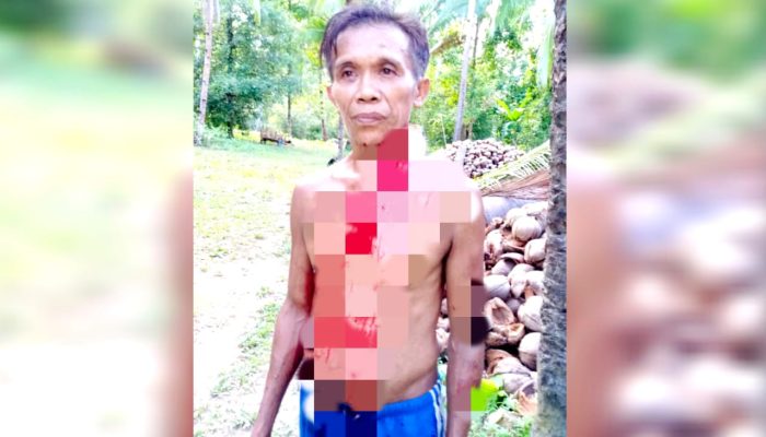 Aniaya Petani Hingga Berdarah, Anggota DPRD Sangihe Cuma Dituntut 3 Bulan