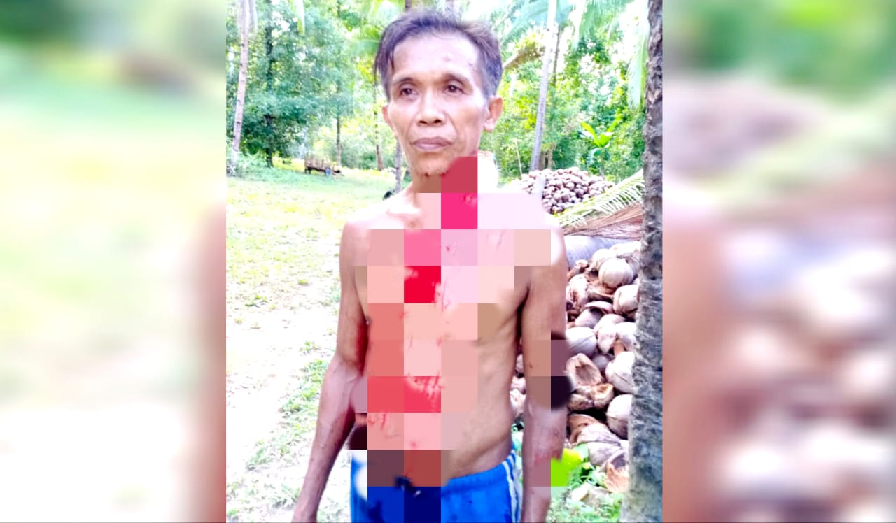 Anggota DPRD Sangihe, FJS, dituntut 3 bulan penjara atas kasus penganiayaan petani hingga berdarah di Pengadilan Negeri Tahuna.